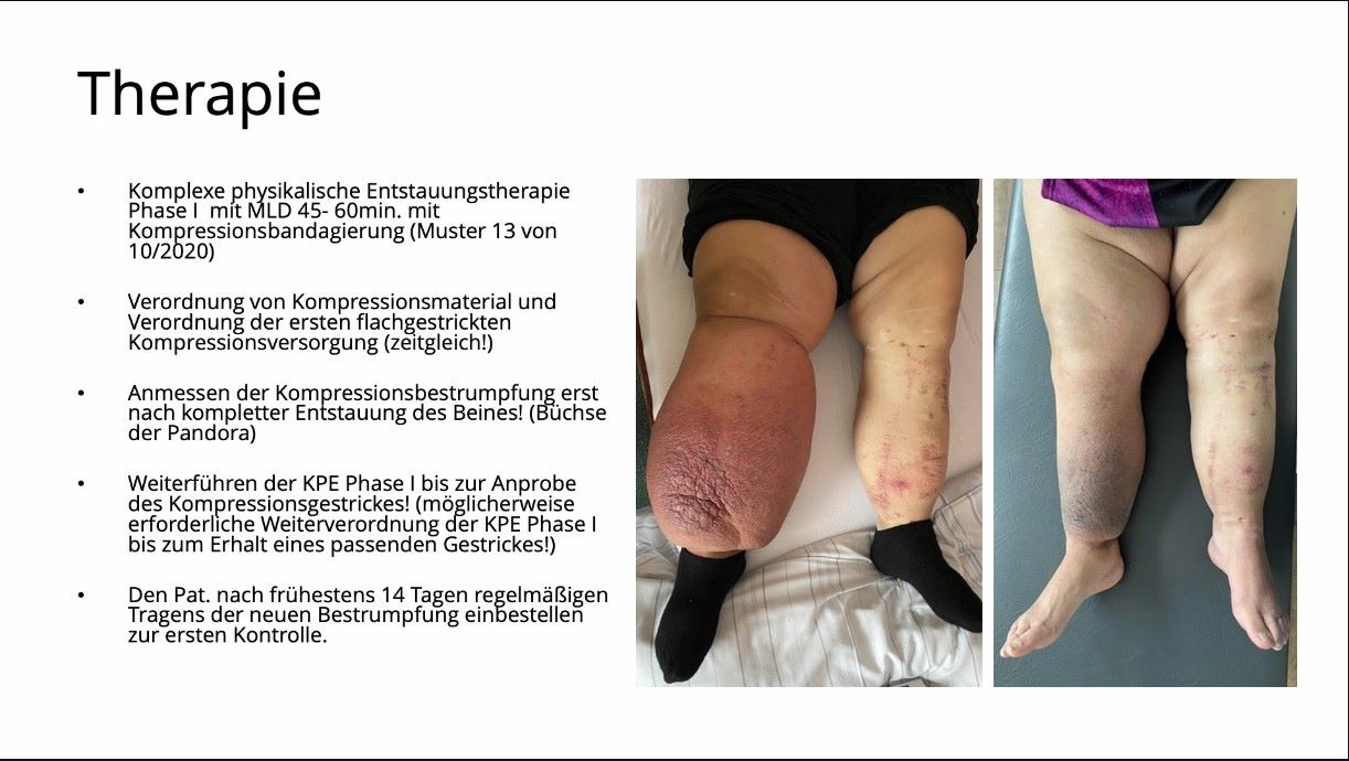 #307: Faszination Lymphologie: Lymphödem & Lipödem – thumbnail 5 of 12