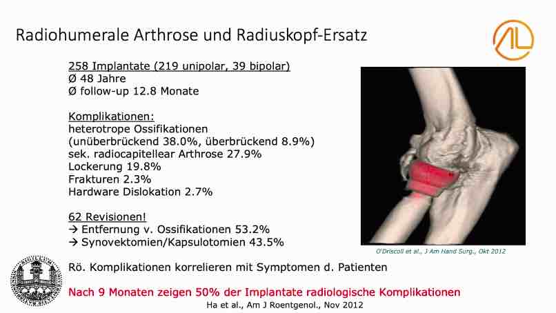 AGAnywhere Monthly - #016: Frakturen des Ellenbogens - Spannungsfeld zwischen Rekonstruktion und Ersatz – thumbnail 5 of 12