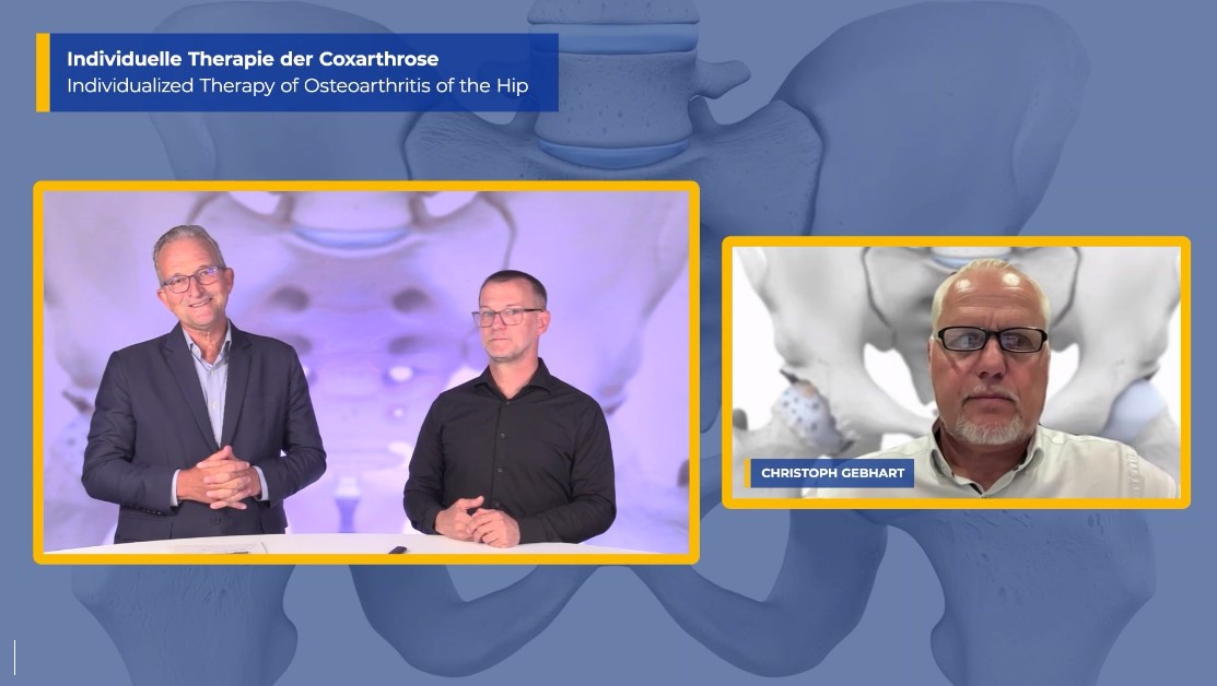 #235: Individualized Therapy of Osteoarthritis of the Hip – thumbnail 5 of 10