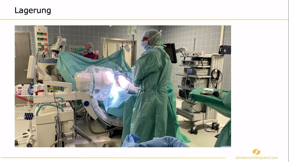 AGAnywhere Road2Berlin – Episode 2: Ossäre Deformitäten bei Kreuzbandverletzung – thumbnail 5 of 11