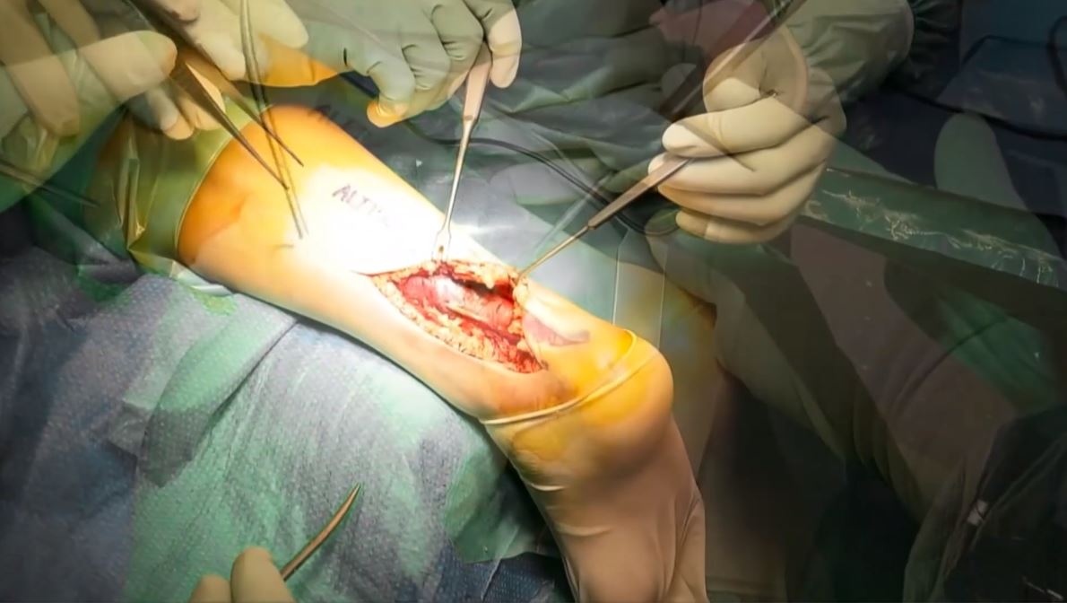 #174: Für die Praxis - Muskel- und Sehnenverletzungen – thumbnail 5 of 13