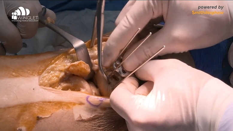 DKOU 2019 Wetlab - BioSkills Workshops & Live-Demonstrationen – thumbnail 5 of 10