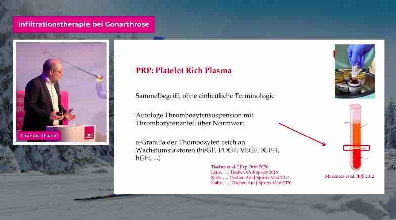 #271: Infiltrationstherapie bei Gonarthrose – thumbnail 5 of 7