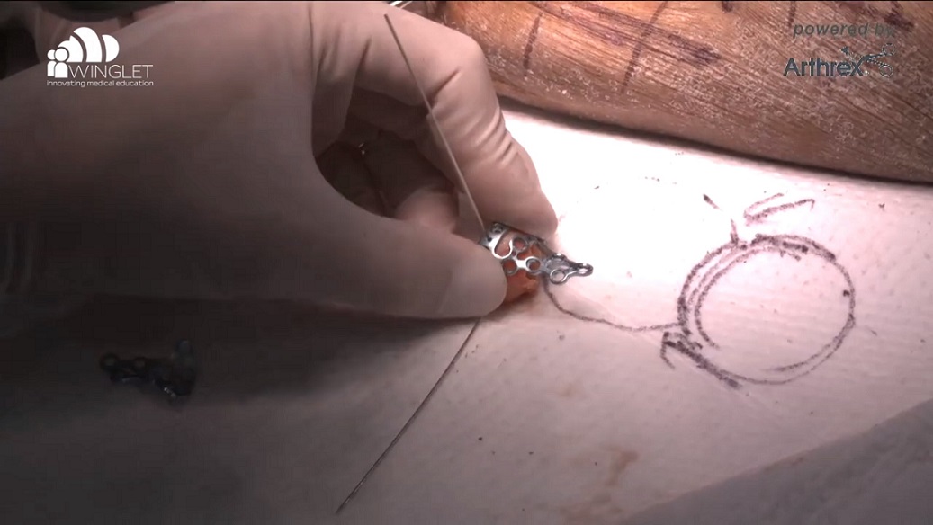 DKOU 2019 Wetlab - BioSkills Workshops & Live-Demonstrationen – thumbnail 6 of 10