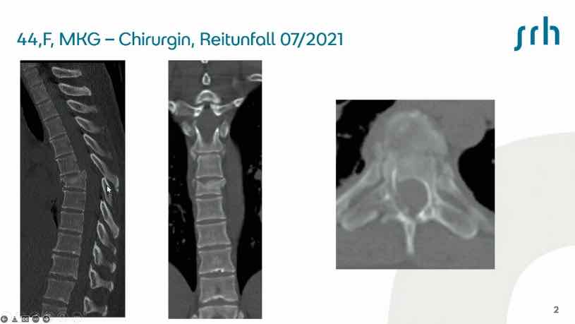 #106: Individualized Treatment of Non-Specific and Specific Back Pain – thumbnail 6 of 10
