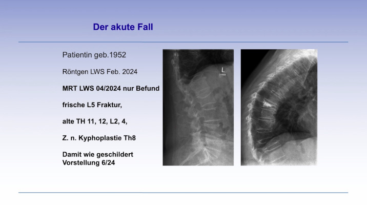 #2711: Osteoporose in der Praxis - Diagnostik und Therapie – thumbnail 6 of 10