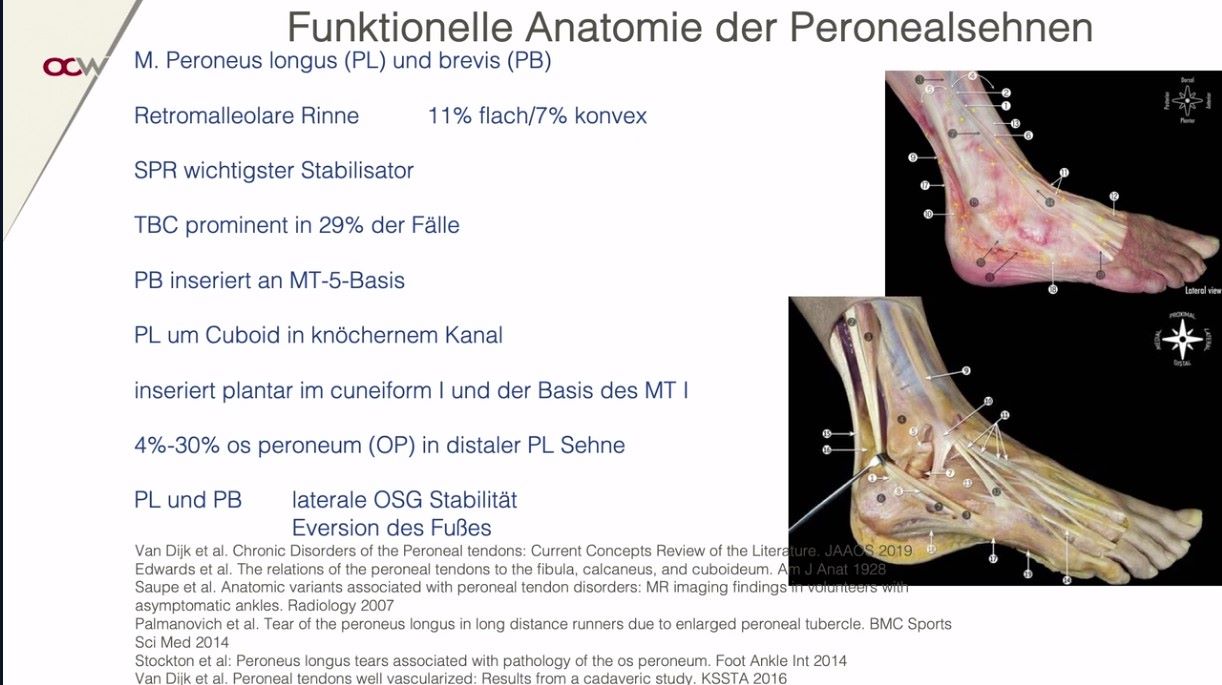 AGAnywhere Monthly - #024: Sehnen rund um das obere Sprunggelenk – thumbnail 6 of 12