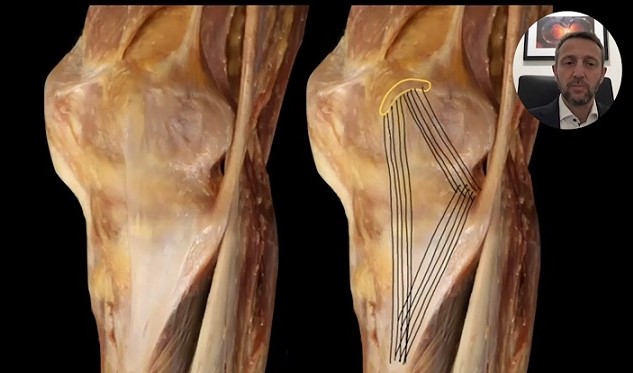 #173: Anatomy and Biomechanics of the Knee – thumbnail 6 of 8
