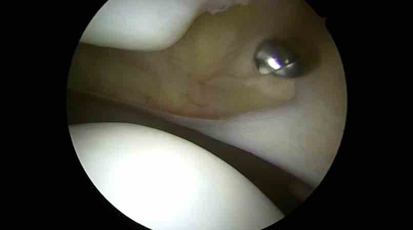 Spezifischer Knieschmerz - Session 2: Patella – thumbnail 6 of 10