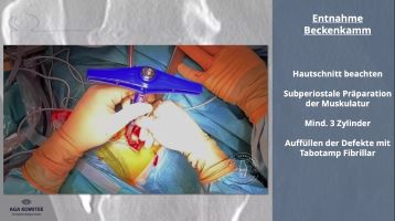 AGAnywhere Monthly - #020: UpDate VKB-Revision: Management und operative Strategien – thumbnail 6 of 12