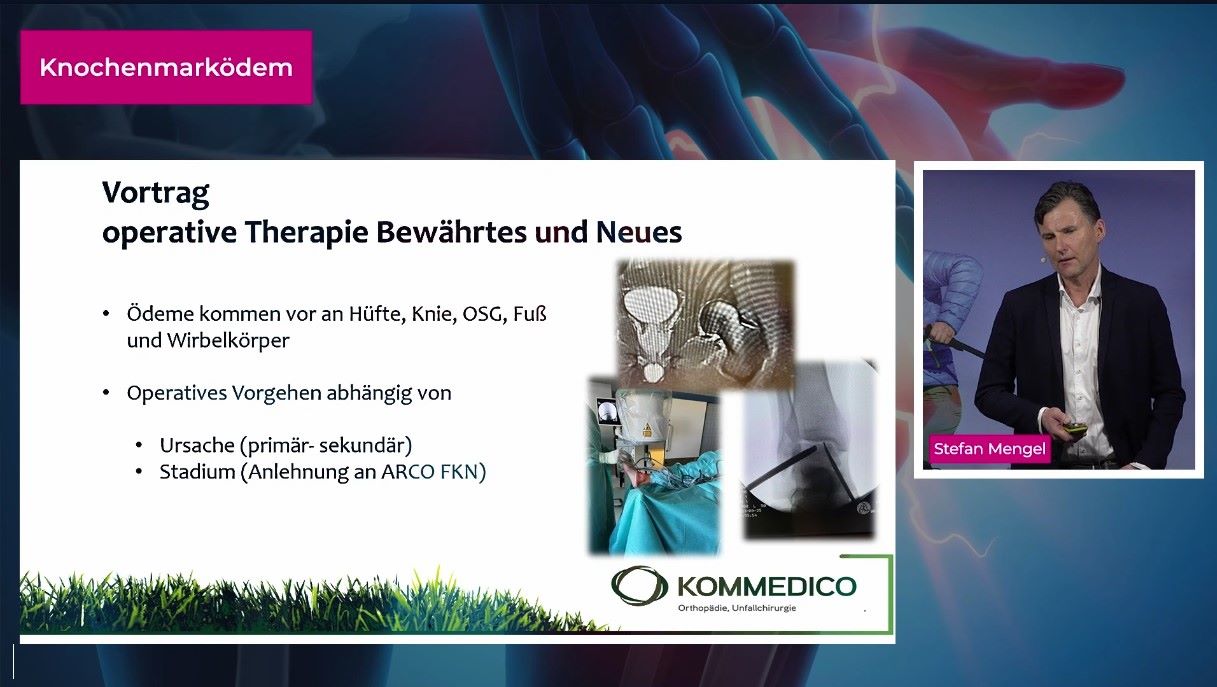 #271: Knochenmarködem – thumbnail 6 of 10