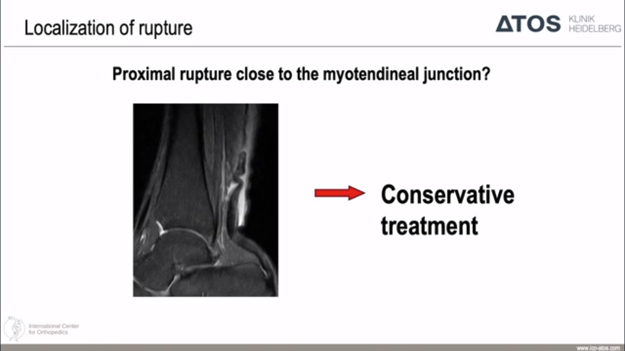 Winglet Originals #017: Degenerative Achilles Tendon Disease – thumbnail 6 of 14