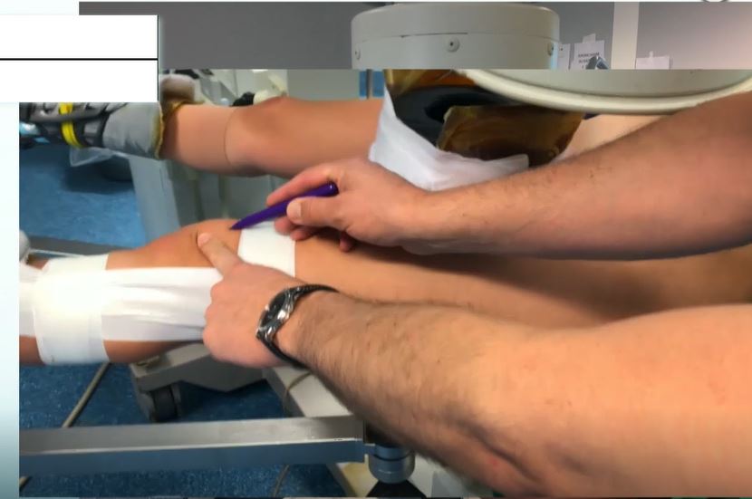 #192: Hip International - Basic Principles of Hip Arthroscopy – thumbnail 6 of 13