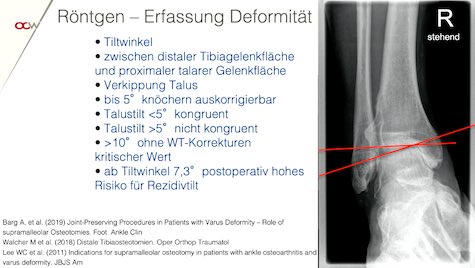#223: Sprunggelenksarthrose - Therapiemöglichkeiten und Grenzbereiche – thumbnail 6 of 10