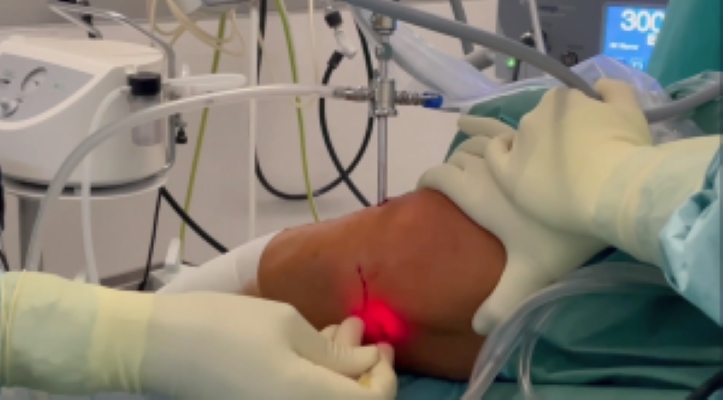 Winglet Originals #014: Basics in Knee Arthroscopy – thumbnail 6 of 19