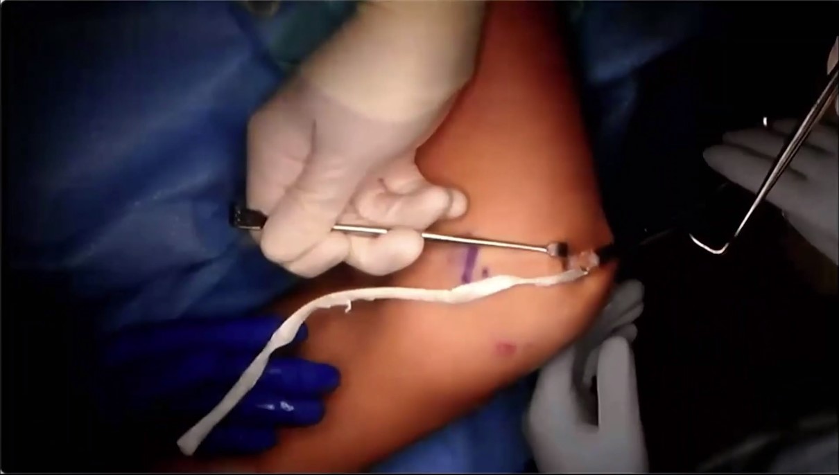 Across the Atlantic: American and European Insights on Patellar Instability – thumbnail 6 of 14