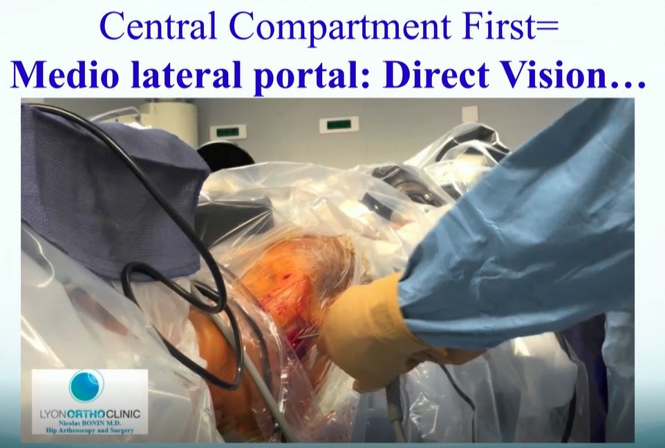 #192: Hip International - Basic Principles of Hip Arthroscopy – thumbnail 7 of 13