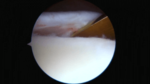 #711: Shoulder International – thumbnail 7 of 12