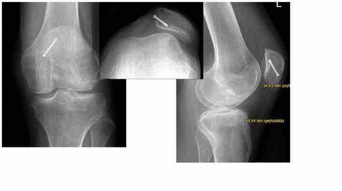 AGAnywhere Road2Vienna – Episode 1: Untere Extremität – thumbnail 6 of 10