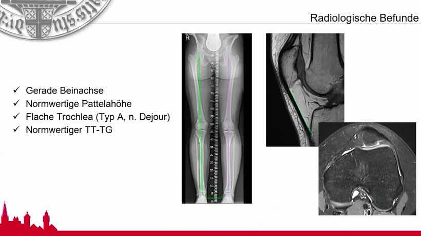 #115: ACT 4.0 Regenerative Knorpeltherapie - so geht's! – thumbnail 7 of 10