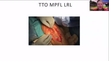 Orthopedic Film Festival 2023 – Lower Extremity & Sports – thumbnail 7 of 17