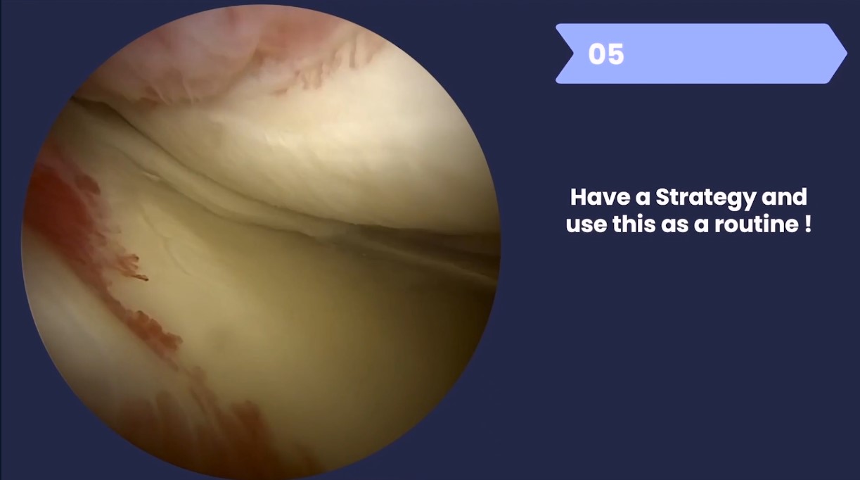 Orthopedic Film Festival 2024 – Lower Extremity & Sports – thumbnail 7 of 16