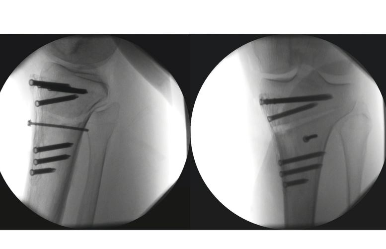 #189: Für die Praxis - Arthrose – thumbnail 7 of 9