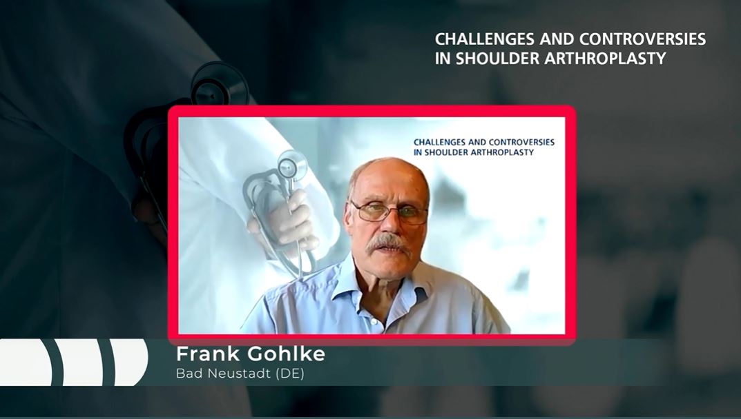 Technology in Shoulder Arthroplasty: Current Developments – thumbnail 7 of 9