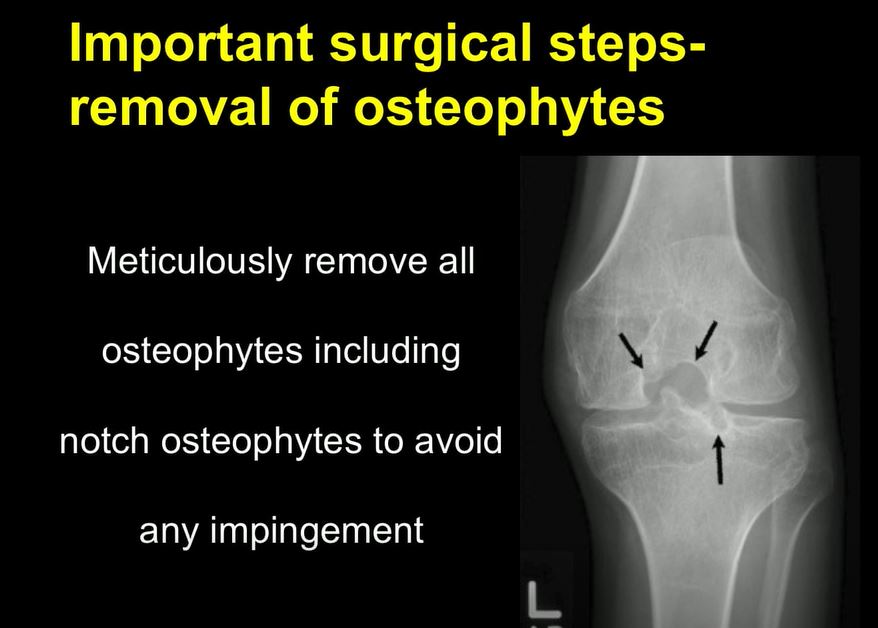#164: Knee International II – thumbnail 7 of 10
