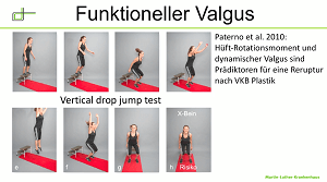 #512: Für die Praxis - Knieverletzungen – thumbnail 6 of 7