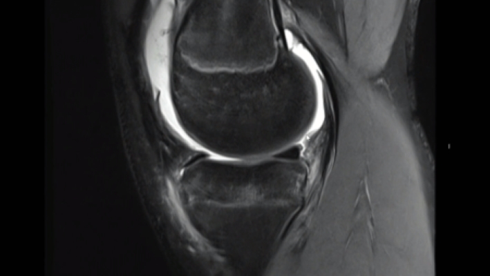 Winglet Originals #014: Basics in Knee Arthroscopy – thumbnail 7 of 19