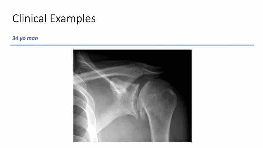 Winglet Originals #006: Shoulder Arthroplasty - Innovations in Diagnostics and Treatment – thumbnail 7 of 10