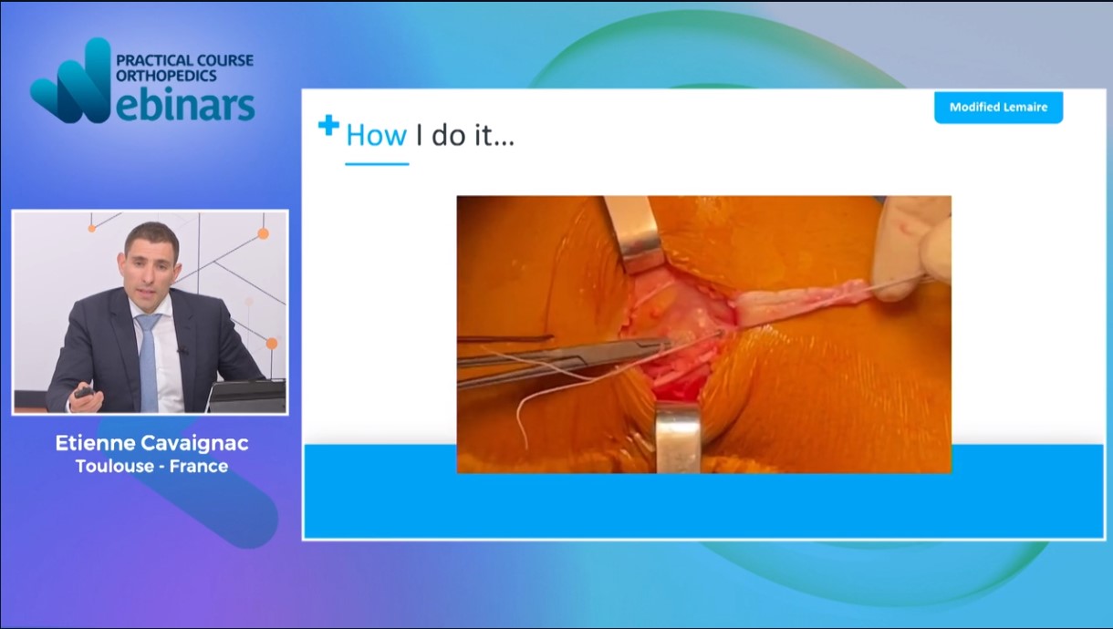 #175: ACL Revision - State of the Art 2023 – thumbnail 7 of 10