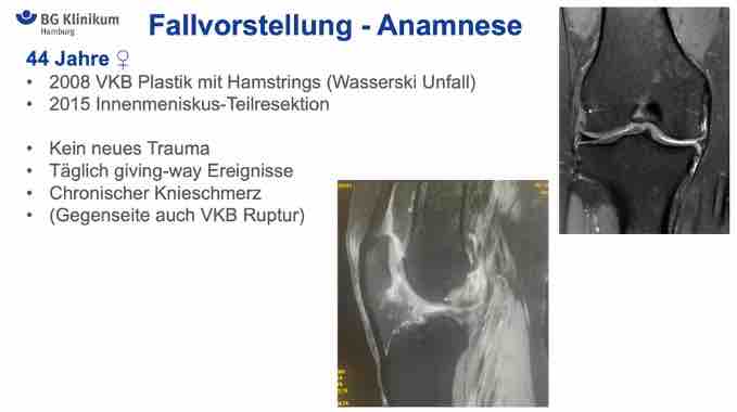 AGAnywhere Road2Vienna – Episode 1: Untere Extremität – thumbnail 7 of 10