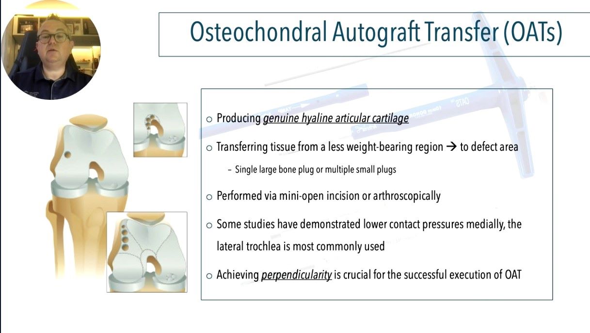 ICRS TV Series - #007: Treatment Options for Articular Cartilage Injuries - An Overview – thumbnail 8 of 10