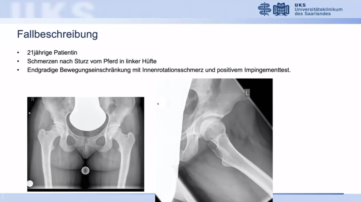 AGAnywhere Monthly - #028: Biomaterialien - Trends in der Knorpel- und Knochenregeneration – thumbnail 8 of 11