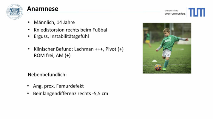 AGAnywhere Monthly - #036: Kindliche Kreuzbandverletzungen – thumbnail 8 of 10
