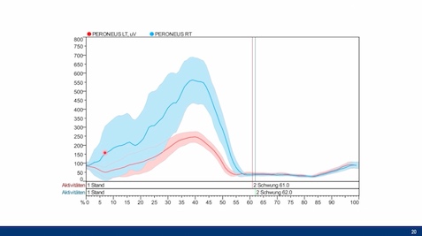 AGAnywhere Monthly - #011: Chronische Sprunggelenkinstabilität – thumbnail 8 of 11