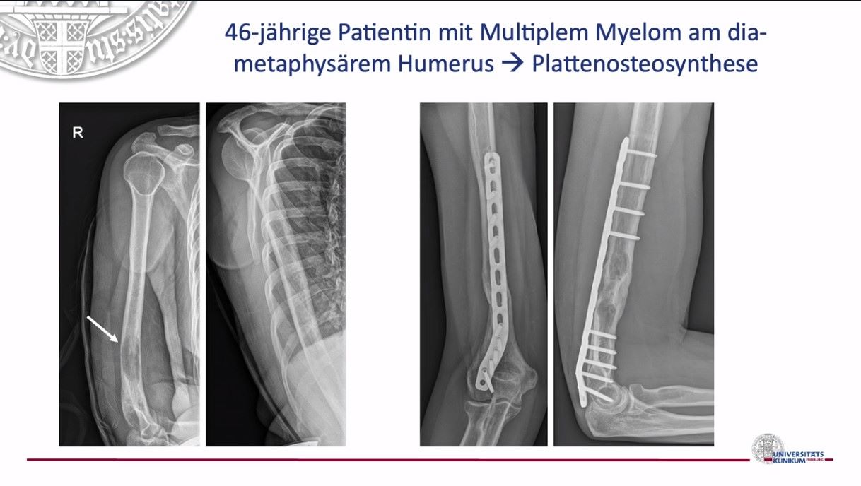 VSOU TV-Serie - Folge 2: Knochentumore – thumbnail 8 of 13