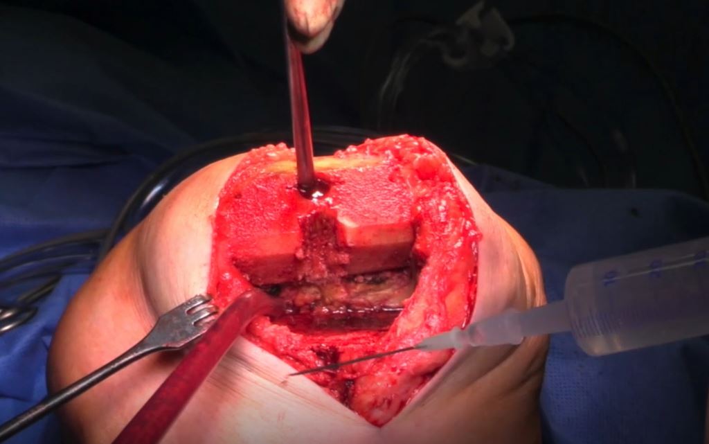 #164: Knee International II – thumbnail 8 of 10