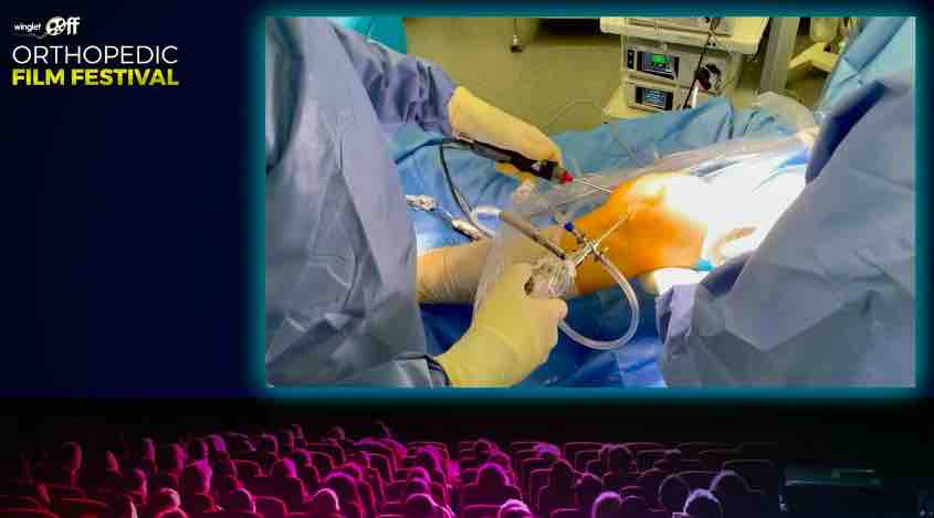 Orthopedic Film Festival 2022 - Lower Extremity – thumbnail 8 of 17