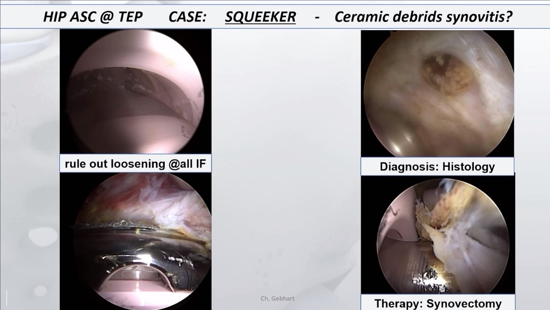 #235: Individualized Therapy of Osteoarthritis of the Hip – thumbnail 8 of 10