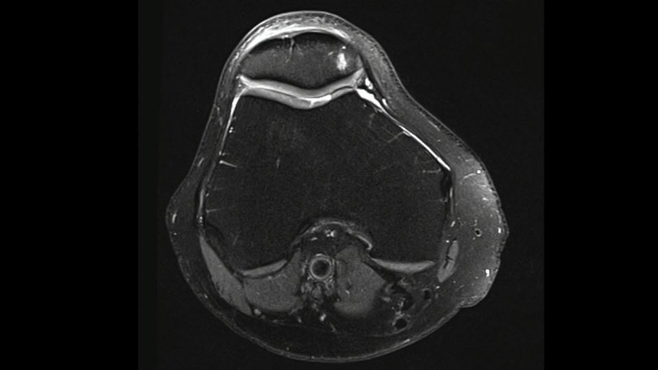 #191: Insights from the OR - Knorpelchirurgie II – thumbnail 8 of 10