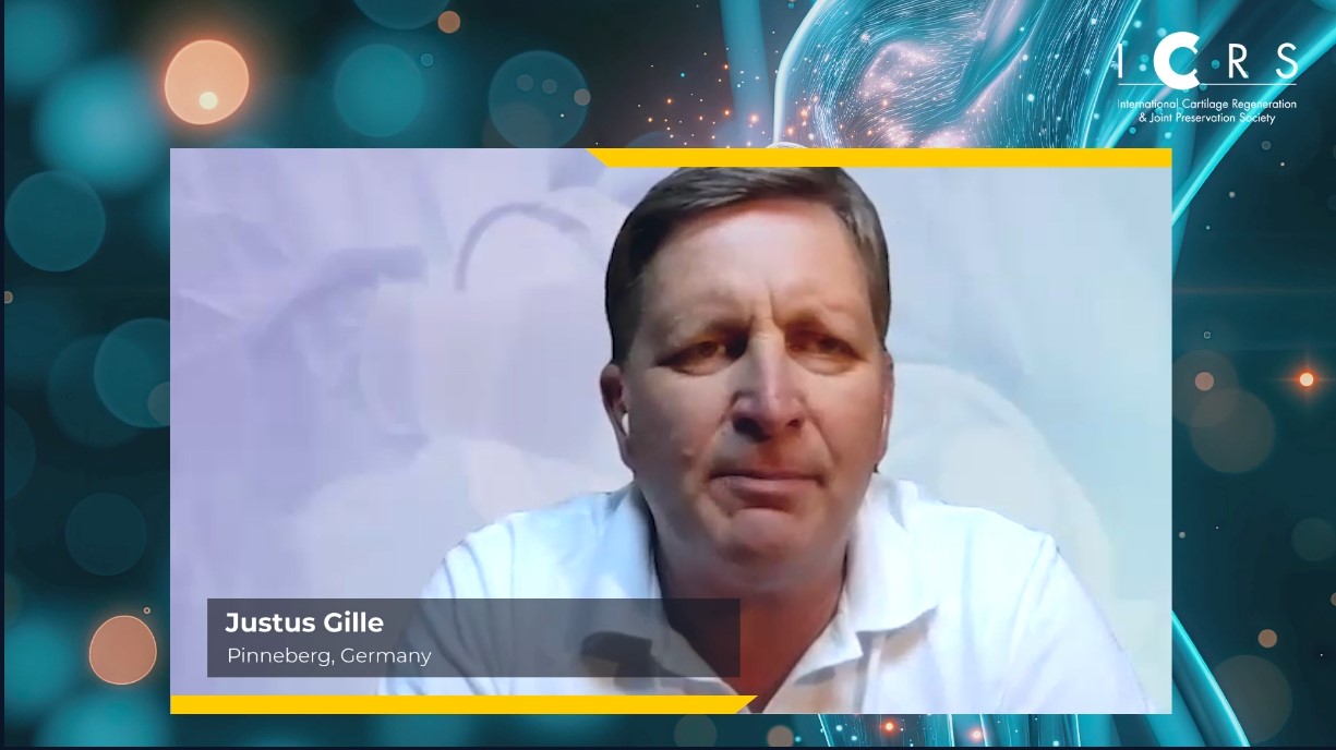 ICRS TV Series - #008: Chondrocyte and Fragmented Cartilage: Products and Procedures – thumbnail 8 of 12