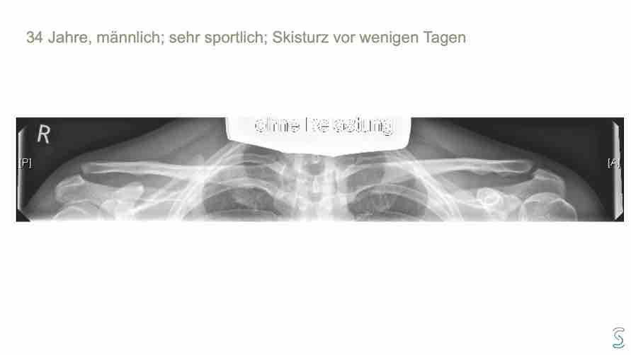 AGAnywhere Monthly - #018: Komplikationen und Management bei ACG-Instabilität – thumbnail 8 of 11