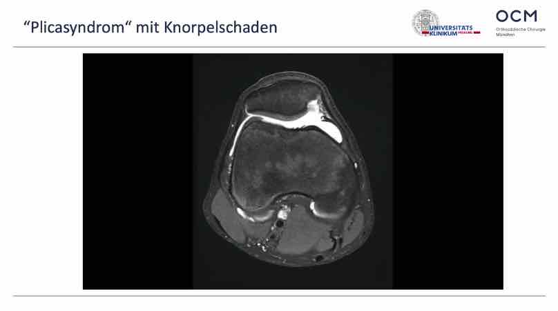Spezifischer Knieschmerz - Session 2: Patella – thumbnail 8 of 10