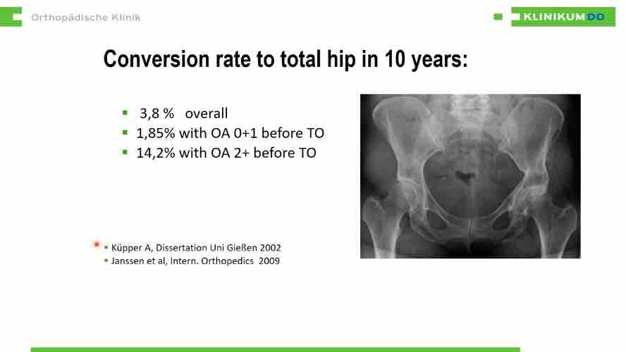 Munich Hip Meeting 2022 – thumbnail 8 of 8