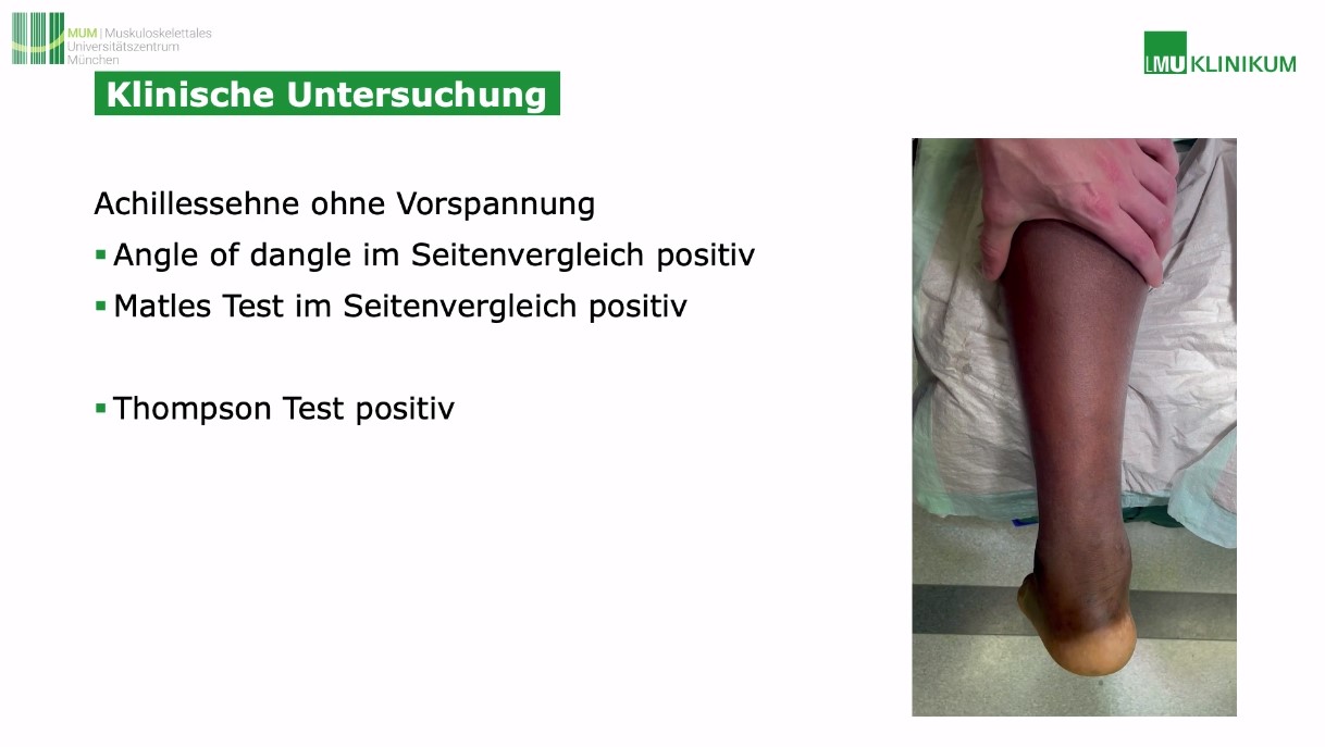 AGAnywhere Monthly - #024: Sehnen rund um das obere Sprunggelenk – thumbnail 8 of 12