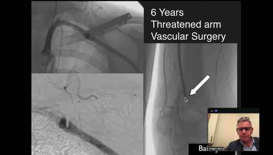 Winglet Originals #005: Clavicle Fractures – thumbnail 9 of 11