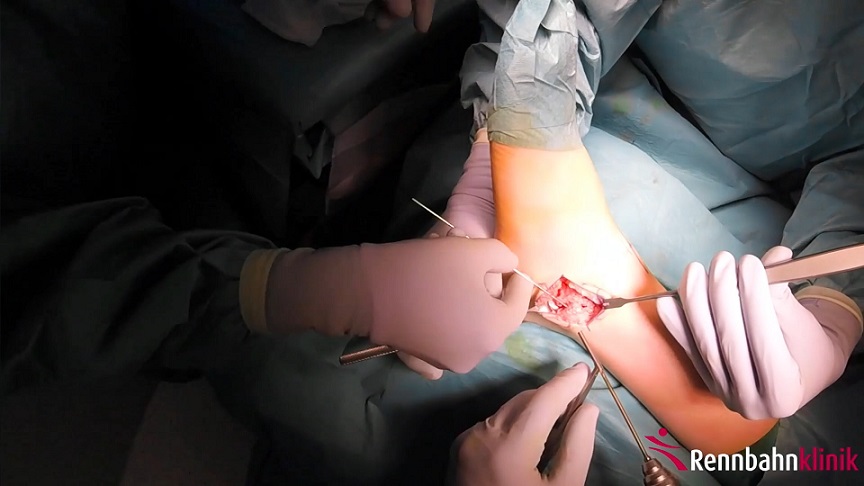 #1012: Für die Praxis - Sprunggelenksdistorsion – thumbnail 9 of 10